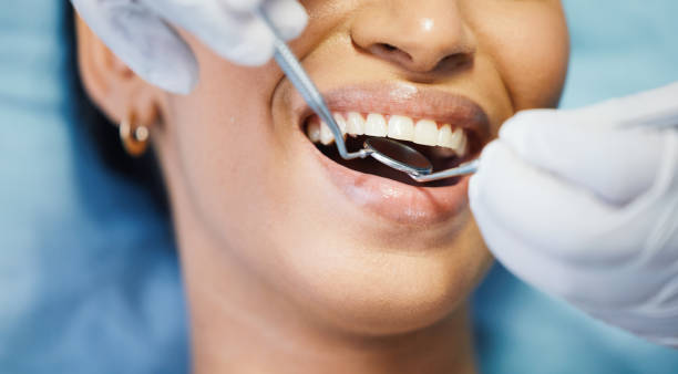 Best Emergency Wisdom Teeth Removal in Sylvania, GA